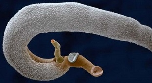 Welche Parasiten können im menschlichen Magen leben 